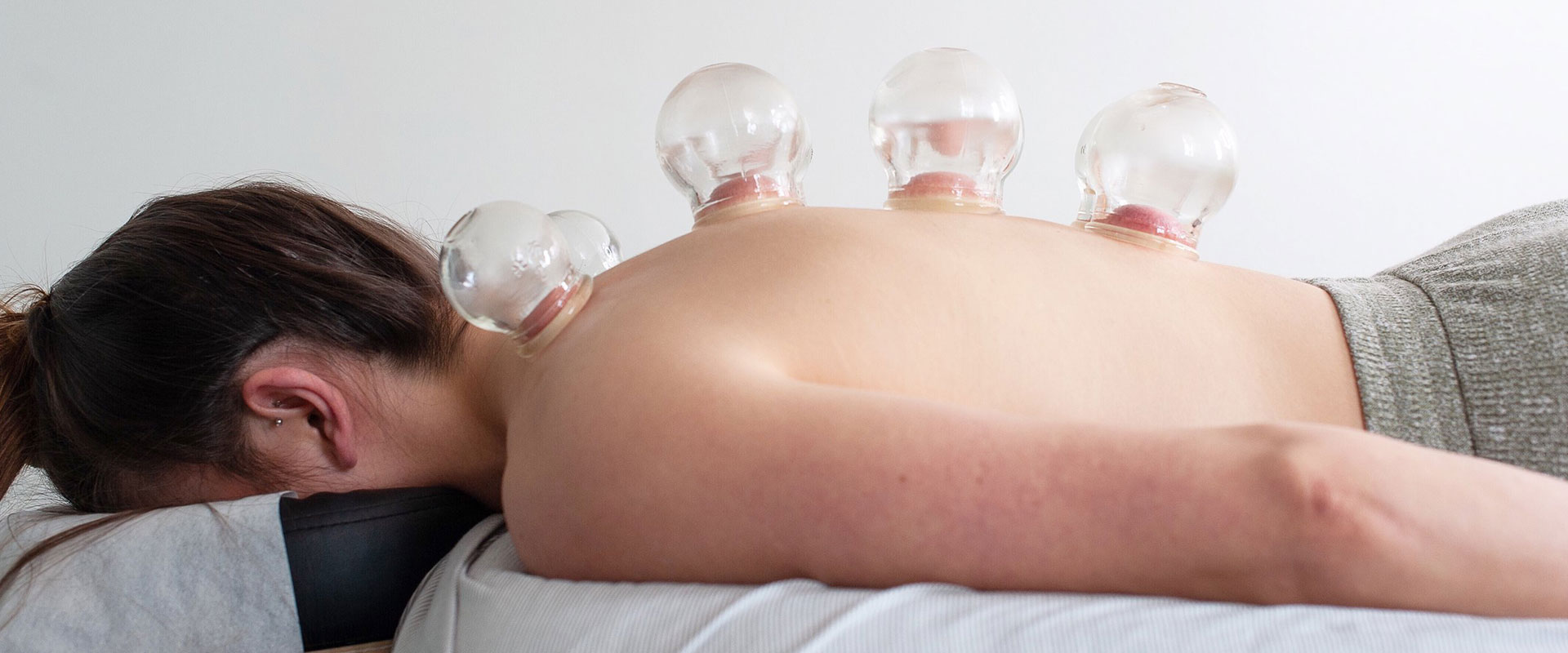 Dynamic-Cupping-Therapy